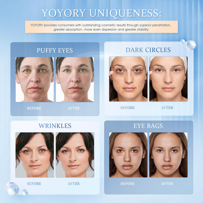 YOYORY Under Eye Patches Masks – Hydrating Hydrogel with Hyaluronic Acid & Peptides