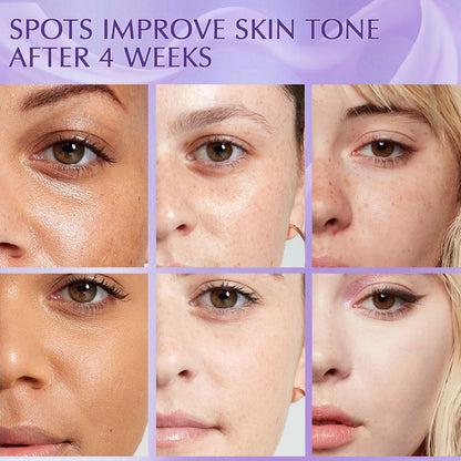YRNVK Dark Spot Remover – Rapid Tone Repair Retinol Cream with Vitamin C
