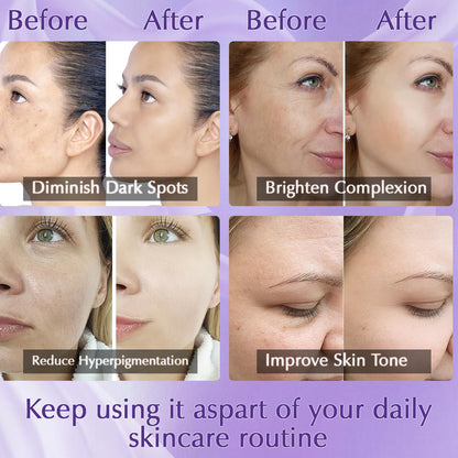 YRNVK Dark Spot Remover – Rapid Tone Repair Retinol Cream with Vitamin C
