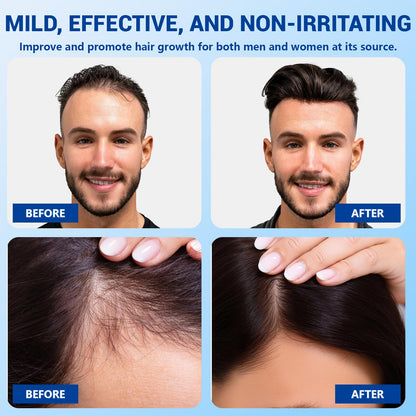 YUFUY Hair Growth Serum Roll-On – No-Rinse, Fast-Absorbing with Rosemary, Castor, Batana Oil & Biotin Niacinamide