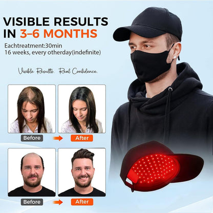 Yuxian Red Light Hair Growth Cap – Portable 660nm LED Hair Care Cap