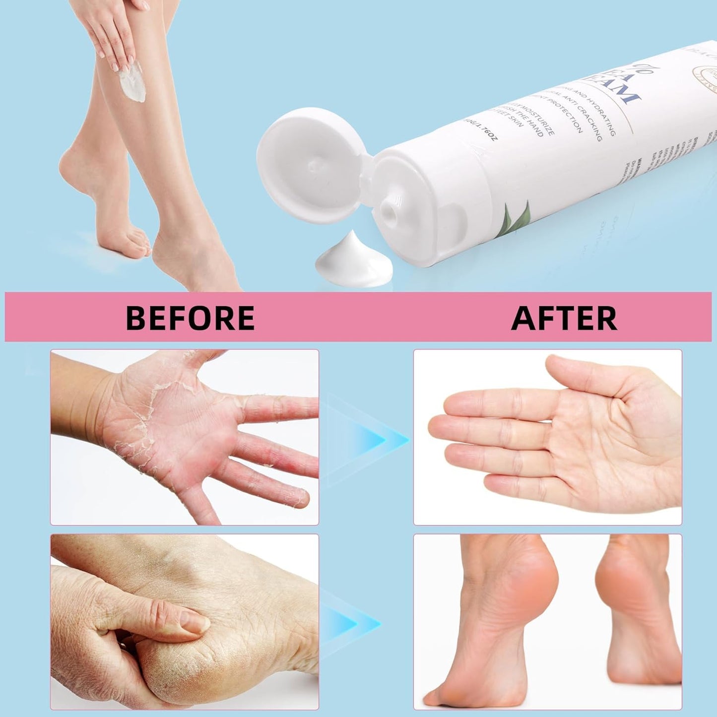 Zegrox Urea Cream 40% — Intensive Foot & Hand Moisturizer (3 x 1.75 oz)