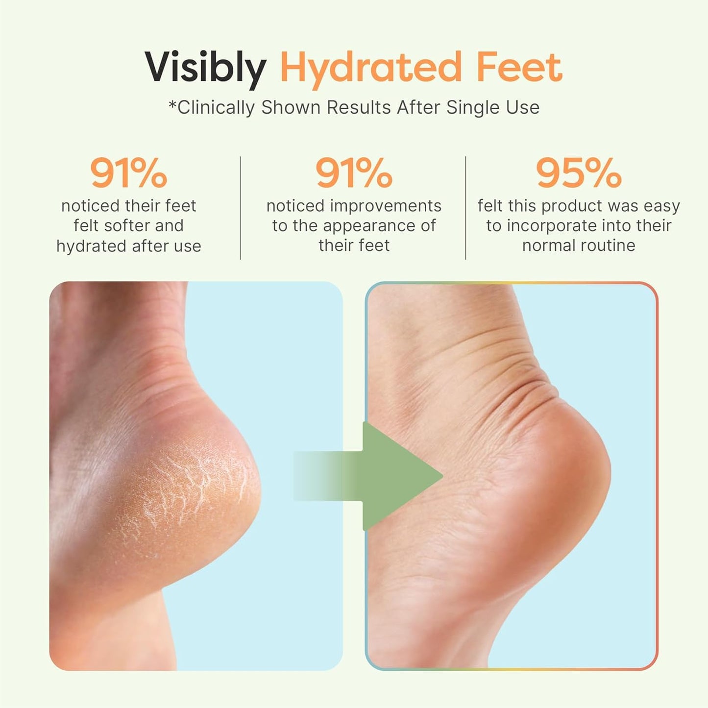 ZenToes Moisturizing Socks for Cracked Heel Treatment – Vitamin E, Olive Oil & Jojoba Infused (Regular, White & Blue Snowflake)