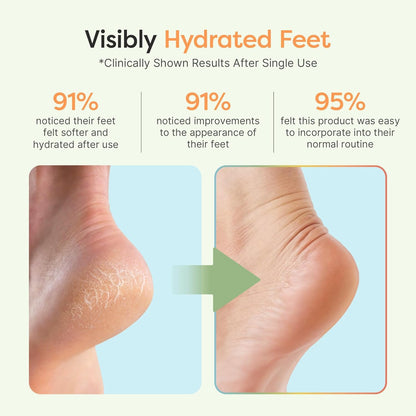 ZenToes Moisturizing Socks for Cracked Heel Treatment – Vitamin E, Olive Oil & Jojoba Infused (Regular, White & Blue Snowflake)