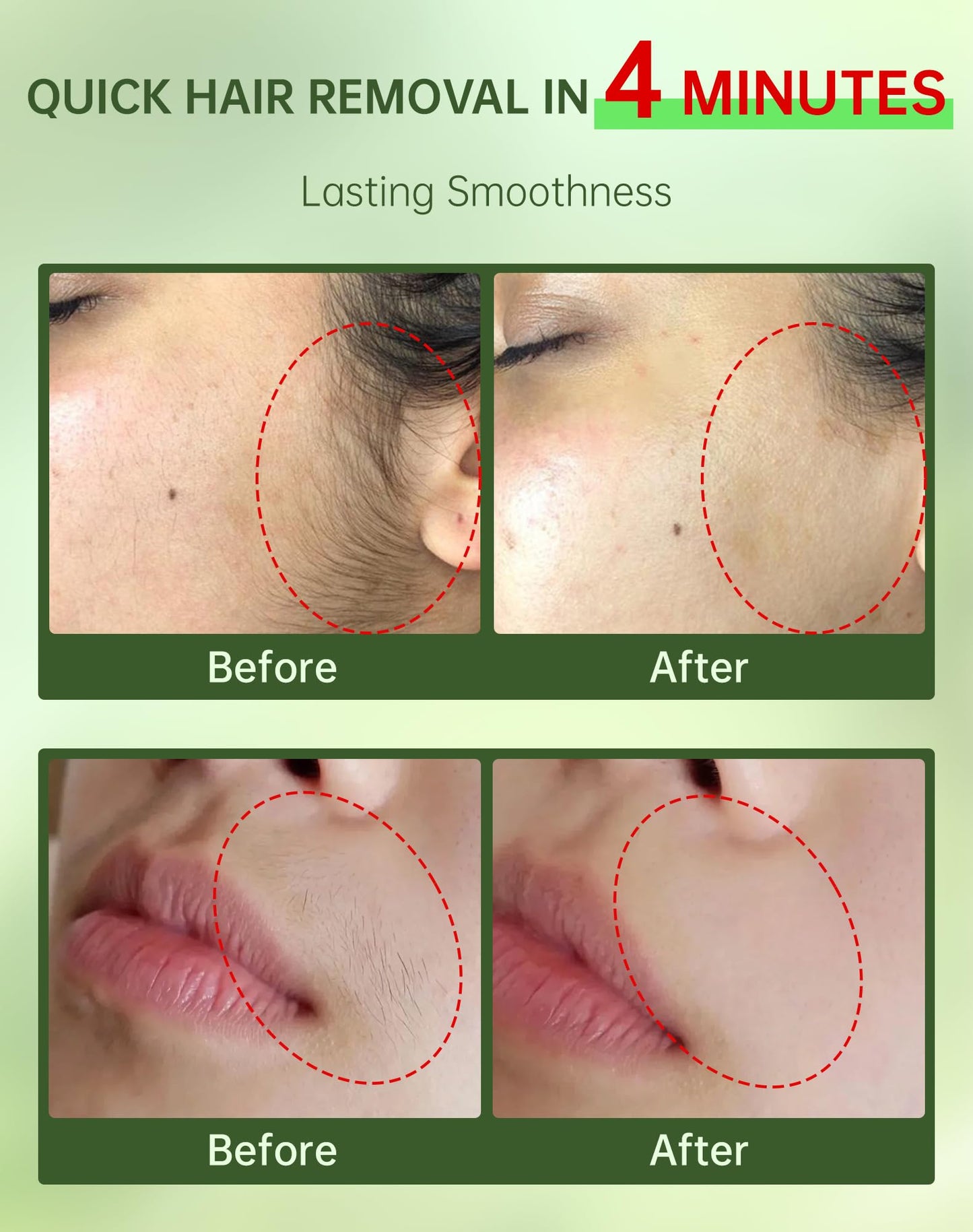 Zeponyx Painless Facial Hair Removal Cream for Women – Sensitive Skin 2-in-1 Kit (4-Minute, 7-Day Smooth) | Upper Lip & Chin