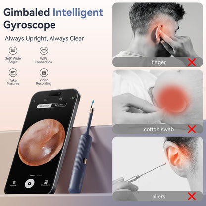 ZERONDER Ear Cleaner with Camera — 1080p Visual Ear Wax Removal Tool