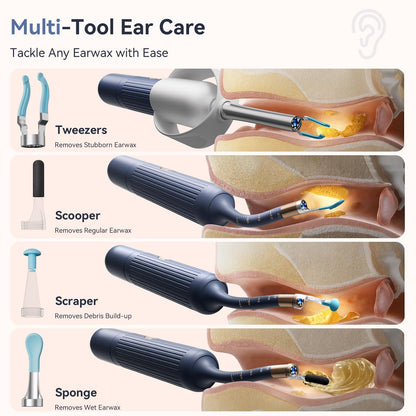 ZERONDER Ear Cleaner with Camera — 1080p Visual Ear Wax Removal Tool