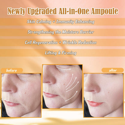 ZEVOFIUR Exosomes Serum with Propolis & ALA Ampoules – Anti-Aging, Firming, Sebum Balance