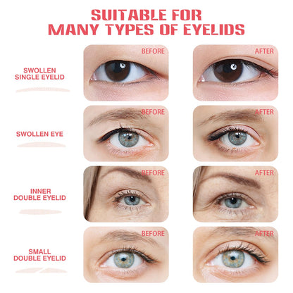 ZYQTQZ Eyelid Tape – Ultra-Thin Invisible Double Eyelid Strips, Waterproof & All-Day Hold (632 Pcs)