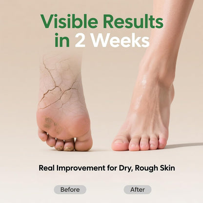 ZyraGloz 60% Urea Cream with 2% Salicylic Acid – Maximum Strength Foot & Hand Moisturizer (10.1 fl oz)